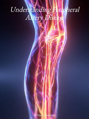 cover image of Understanding Peripheral Artery Disease
